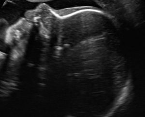 Perinatologia – czyli opieka przed narodzeniem