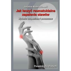 Jak leczyć reumatoidalne zapalenie stawów ? Poradnik dla chorych